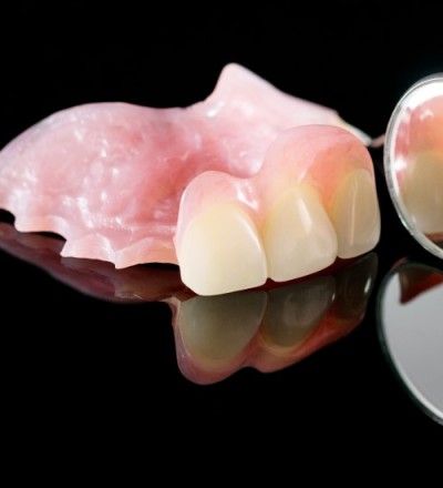 Dentures, Missing teeth, Dentist High Wycombe